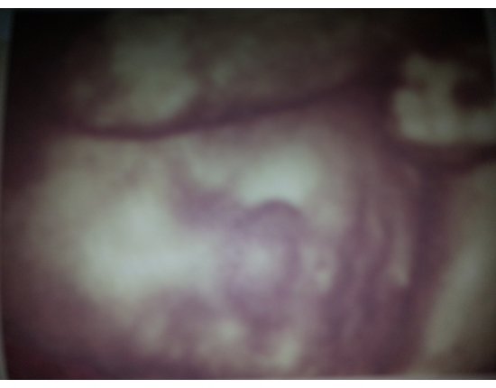 35 неделя беременности фото ребенка